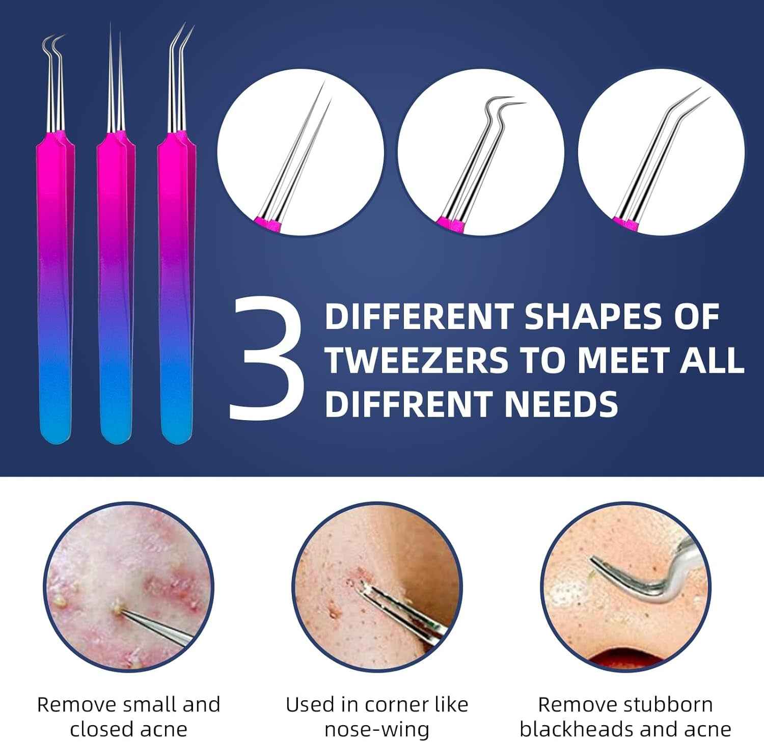 Pimple Popper Tool Kit -  10 Pcs Blackhead Remover Comedone Extractor Kit with Metal Case for Quick and Easy Removal of Blackheads, Zit Removing, Facial and Nose(Colorful) - Clickitcome